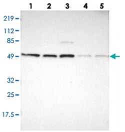 PSMC1, Rabbit, Polyclonal Antibody, Abnova 100&mu;L; Unlabeled:Antibodies,