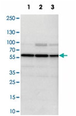 PSMC1, Rabbit, Polyclonal Antibody, Abnova 100&mu;L; Unlabeled:Antibodies,