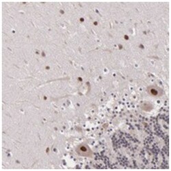 PSMC1, Rabbit, Polyclonal Antibody, Abnova 100&mu;L; Unlabeled:Antibodies,