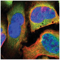 PSMC1, Rabbit, Polyclonal Antibody, Abnova 100&mu;L; Unlabeled:Antibodies,