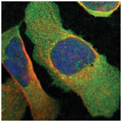 FGD1, Rabbit, Polyclonal Antibody, Abnova 100&mu;L; Unlabeled:Antibodies,