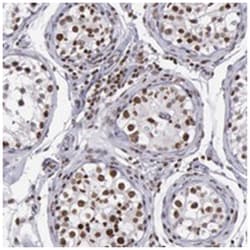 NKAP, Rabbit, Polyclonal Antibody, Abnova 100 &mu;L | Buy Online | Abnova | Fisher Scientific