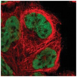 NKAP, Rabbit, Polyclonal Antibody, Abnova 100 &mu;L | Buy Online | Abnova | Fisher Scientific