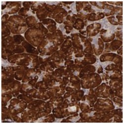 PPP1R3F, Rabbit, Polyclonal Antibody, Abnova 100 &mu;L | Buy Online | Abnova Corporation | Fisher Scientific