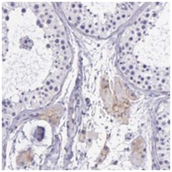THSD7A, Rabbit, Polyclonal Antibody, Abnova 100 &mu;L | Buy Online | Abnova Corporation | Fisher Scientific