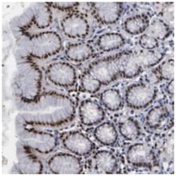 TRMT5, Rabbit, Polyclonal Antibody, Abnova 100 &mu;L | Buy Online | Abnova Corporation | Fisher Scientific