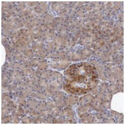 ANGEL1, Rabbit, Polyclonal Antibody, Abnova 100&mu;L; Unlabeled:Antibodies,