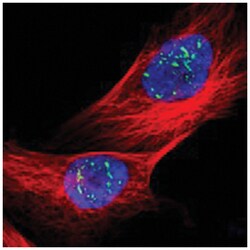 BRD1, Rabbit, Polyclonal Antibody, Abnova 100&mu;L; Unlabeled:Antibodies,