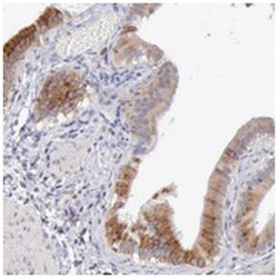 SASH3, Rabbit, Polyclonal Antibody, Abnova 100 &mu;L | Buy Online | Abnova Corporation | Fisher Scientific