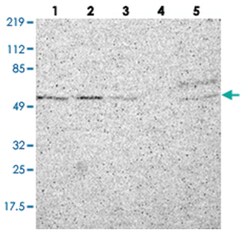 C22orf28, Rabbit, Polyclonal Antibody, Abnova 100&mu;L; Unlabeled:Antibodies,