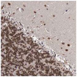 C22orf28, Rabbit, Polyclonal Antibody, Abnova 100&mu;L; Unlabeled:Antibodies,
