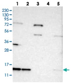 SNRPD3, Rabbit, Polyclonal Antibody, Abnova 100 &mu;L | Buy Online | Abnova Corporation | Fisher Scientific