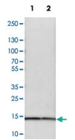 SNRPD3, Rabbit, Polyclonal Antibody, Abnova 100 &mu;L | Buy Online | Abnova Corporation | Fisher Scientific