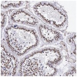 SNRPD3, Rabbit, Polyclonal Antibody, Abnova 100 &mu;L | Buy Online | Abnova Corporation | Fisher Scientific