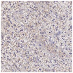 TBC1D22A, Rabbit, Polyclonal Antibody, Abnova 100&mu;L; Unlabeled:Antibodies,