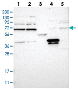 PRPF39, Rabbit, Polyclonal Antibody, Abnova 100&mu;L; Unlabeled:Antibodies,