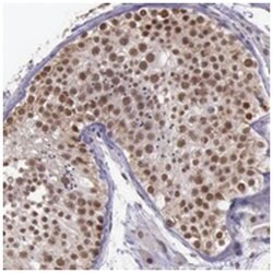 PRPF39, Rabbit, Polyclonal Antibody, Abnova 100&mu;L; Unlabeled:Antibodies,