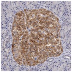 TMED8, Rabbit, Polyclonal Antibody, Abnova 100 &mu;L | Buy Online | Abnova Corporation | Fisher Scientific