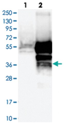 TMED8, Rabbit, Polyclonal Antibody, Abnova 100 &mu;L | Buy Online | Abnova Corporation | Fisher Scientific