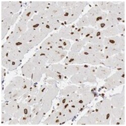UNC84B, Rabbit, Polyclonal Antibody, Abnova 100&mu;L; Unlabeled:Antibodies,