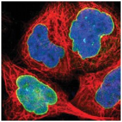 UNC84B, Rabbit, Polyclonal Antibody, Abnova 100&mu;L; Unlabeled:Antibodies,