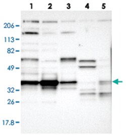 CCDC50, Rabbit, Polyclonal Antibody, Abnova 100&mu;L; Unlabeled:Antibodies,