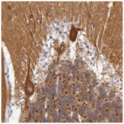 MYO5A, Rabbit, Polyclonal Antibody, Abnova 100&mu;L; Unlabeled:Antibodies,