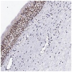 SIX6 Rabbit anti-Human, Polyclonal Antibody, Abnova 100 &mu;L | Buy Online | Abnova Corporation | Fisher Scientific