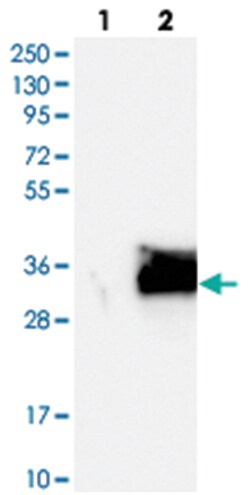 SIX6 Rabbit anti-Human, Polyclonal Antibody, Abnova 100 &mu;L | Buy Online | Abnova Corporation | Fisher Scientific
