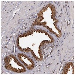 GLIS1, Rabbit, Polyclonal Antibody, Abnova 100&mu;L; Unlabeled:Antibodies,