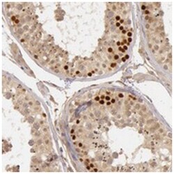 CTCFL Rabbit anti-Human, Polyclonal Antibody, Abnova 100&mu;L; Unlabeled:Antibodies,