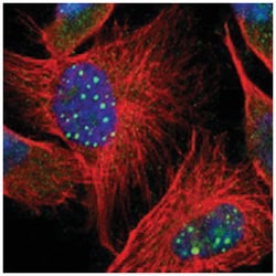 CTCFL Rabbit anti-Human, Polyclonal Antibody, Abnova 100&mu;L; Unlabeled:Antibodies,