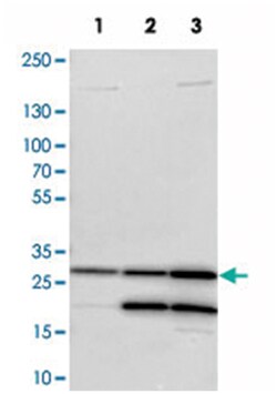 CA2 Rabbit anti-Human, Mouse, Rat, Polyclonal Antibody, Abnova 100 &mu;L | Buy Online | Abnova | Fisher Scientific