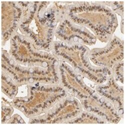 CA2 Rabbit anti-Human, Mouse, Rat, Polyclonal Antibody, Abnova 100 &mu;L | Buy Online | Abnova | Fisher Scientific
