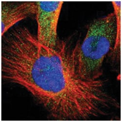 CA2 Rabbit anti-Human, Mouse, Rat, Polyclonal Antibody, Abnova 100 &mu;L | Buy Online | Abnova | Fisher Scientific