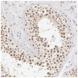 ZNF597, Rabbit, Polyclonal Antibody, Abnova 100&mu;L; Unlabeled:Antibodies,