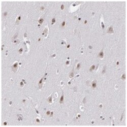 RRP7A, Rabbit, Polyclonal Antibody, Abnova 100&mu;L; Unlabeled:Antibodies,