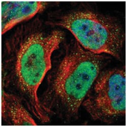 DNMT3B Rabbit anti-Human, Polyclonal Antibody, Abnova 100&mu;L; Unlabeled:Antibodies,