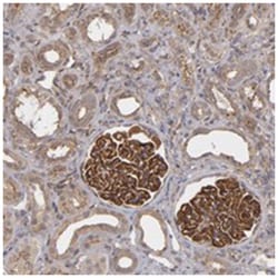 TJP1 Rabbit anti-Human, Polyclonal Antibody, Abnova 100 &mu;L | Buy Online | Abnova Corporation | Fisher Scientific