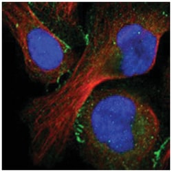 TJP1 Rabbit anti-Human, Polyclonal Antibody, Abnova 100 &mu;L | Buy Online | Abnova Corporation | Fisher Scientific