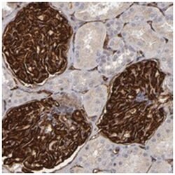 SLC9A3R2, Rabbit, Polyclonal Antibody, Abnova 100&mu;L; Unlabeled:Antibodies,