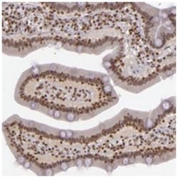 ZFY, Rabbit, Polyclonal Antibody, Abnova 100&mu;L; Unlabeled:Antibodies,