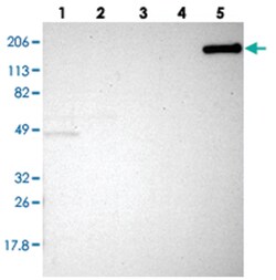 MYOM2 Rabbit anti-Human, Polyclonal Antibody, Abnova 100 &mu;L | Buy Online | Abnova Corporation | Fisher Scientific
