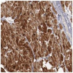 MYOM2 Rabbit anti-Human, Polyclonal Antibody, Abnova 100 &mu;L | Buy Online | Abnova Corporation | Fisher Scientific