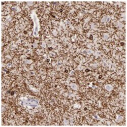 ZC3H7B Rabbit anti-Human, Polyclonal Antibody, Abnova 100&mu;L; Unlabeled:Antibodies,