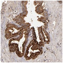 CFB Rabbit anti-Human, Polyclonal Antibody, Abnova 100&mu;L; Unlabeled:Antibodies,