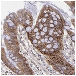FAT1 Rabbit anti-Human, Polyclonal Antibody, Abnova 100 &mu;L | Buy Online | Abnova Corporation | Fisher Scientific