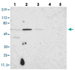 UPF3B Rabbit anti-Human, Polyclonal Antibody, Abnova 100&mu;L; Unlabeled:Antibodies,