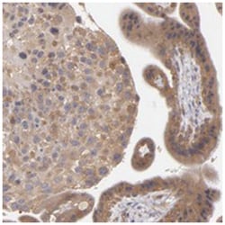 UPF3B Rabbit anti-Human, Polyclonal Antibody, Abnova 100&mu;L; Unlabeled:Antibodies,