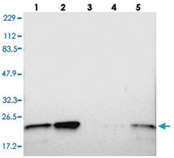 TAGLN2, Rabbit, Polyclonal Antibody, Abnova 100 &mu;L | Buy Online | Abnova Corporation | Fisher Scientific